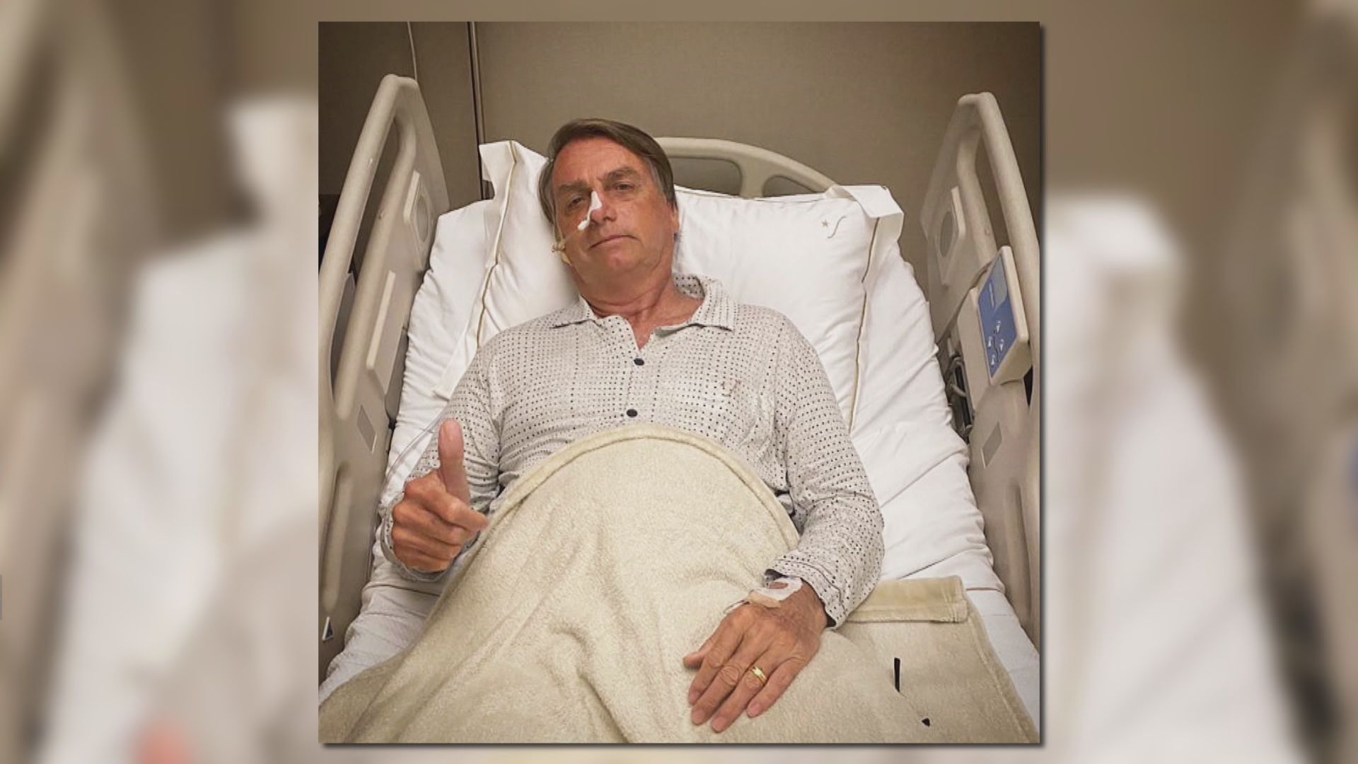 巴西總統博索納羅腸道阻塞入院　現情況穩定