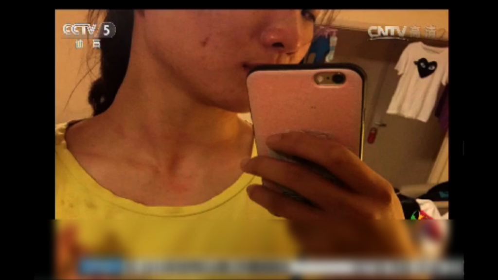 有中國運動員里約被搶劫