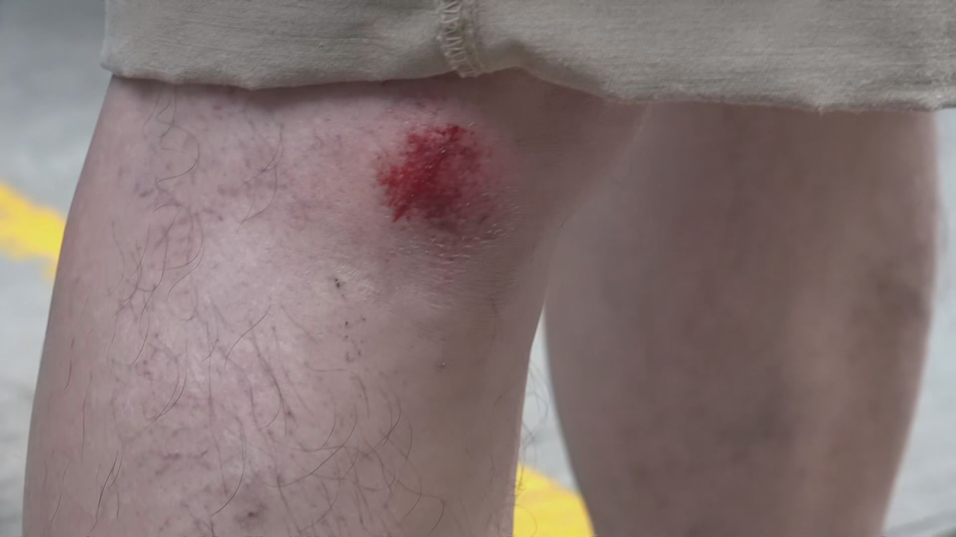 銅鑼灣刺傷警員案　警車押解被告時撞跌多名攝影師