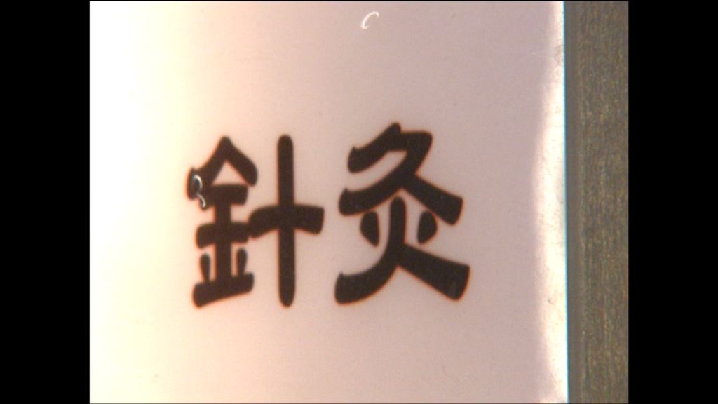 女子針灸猝死被判死於自然　家屬盼慘劇不會重演