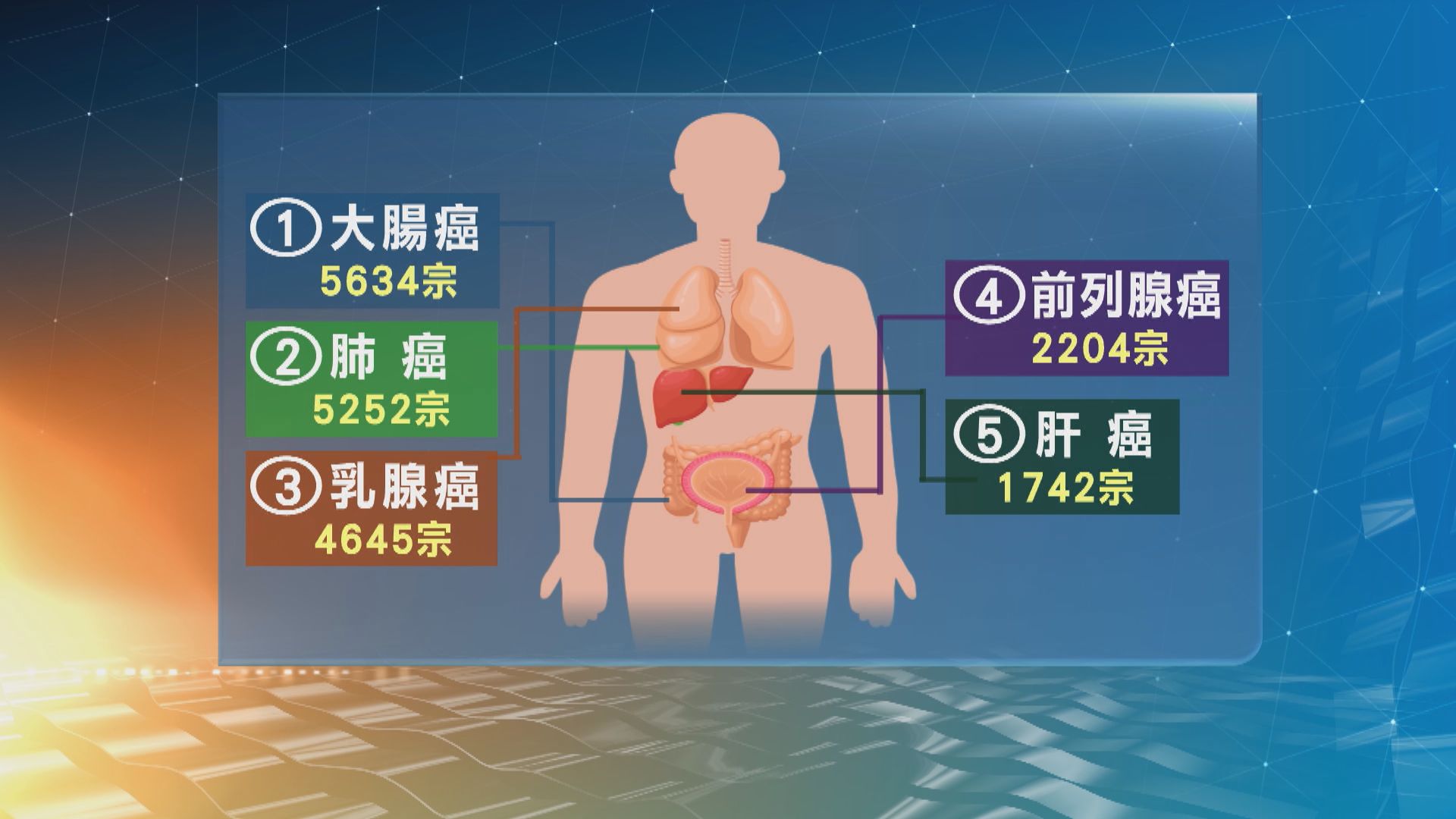 中年女性人口增　乳癌新症個案近年大增