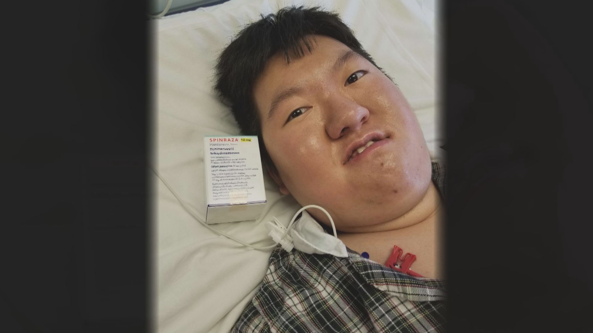 六名脊髓肌肉萎縮症患者正接受治療