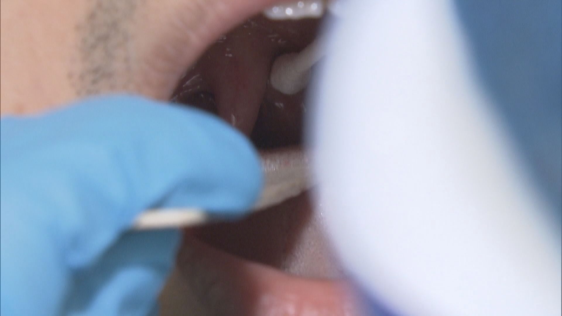 陳肇始：醫護參與協助全民檢測採樣反應積極