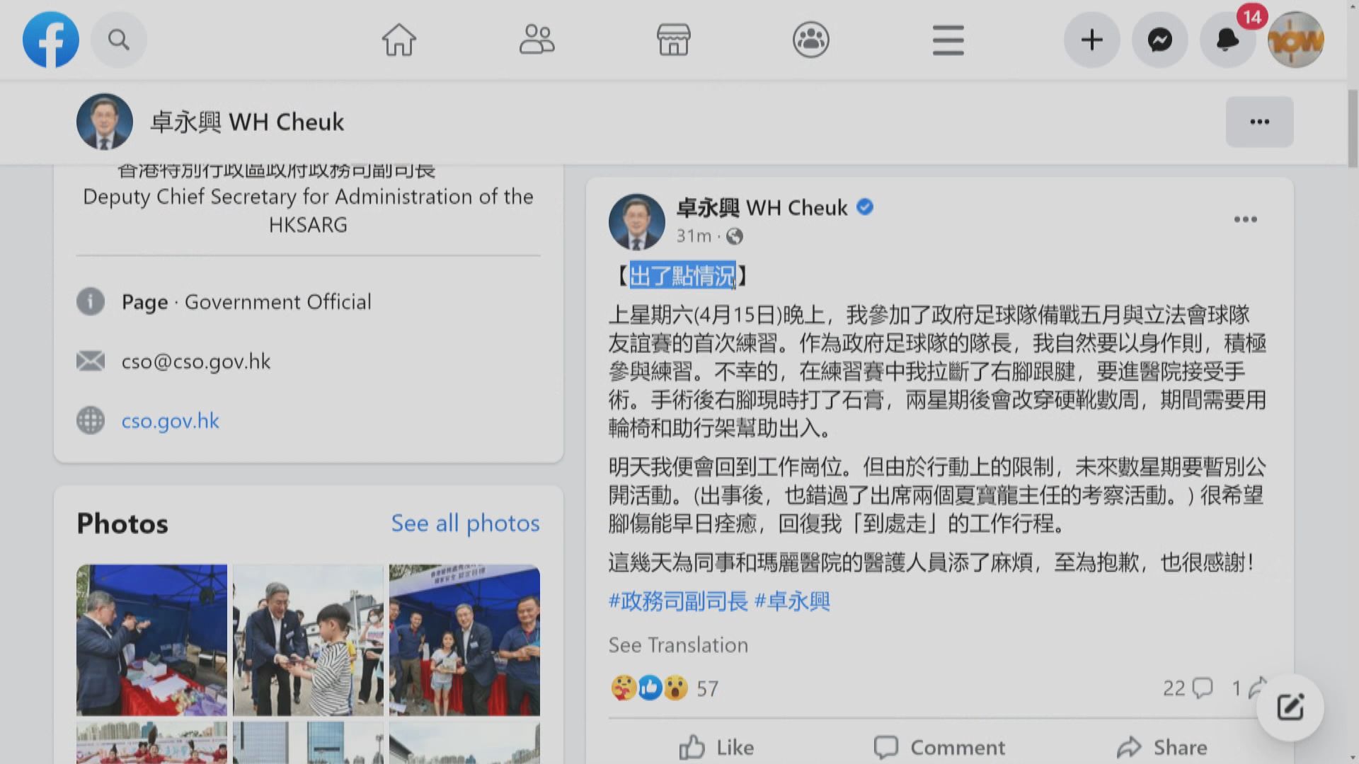 卓永興拉斷右腳跟踺入院做手術　需坐輪椅出入