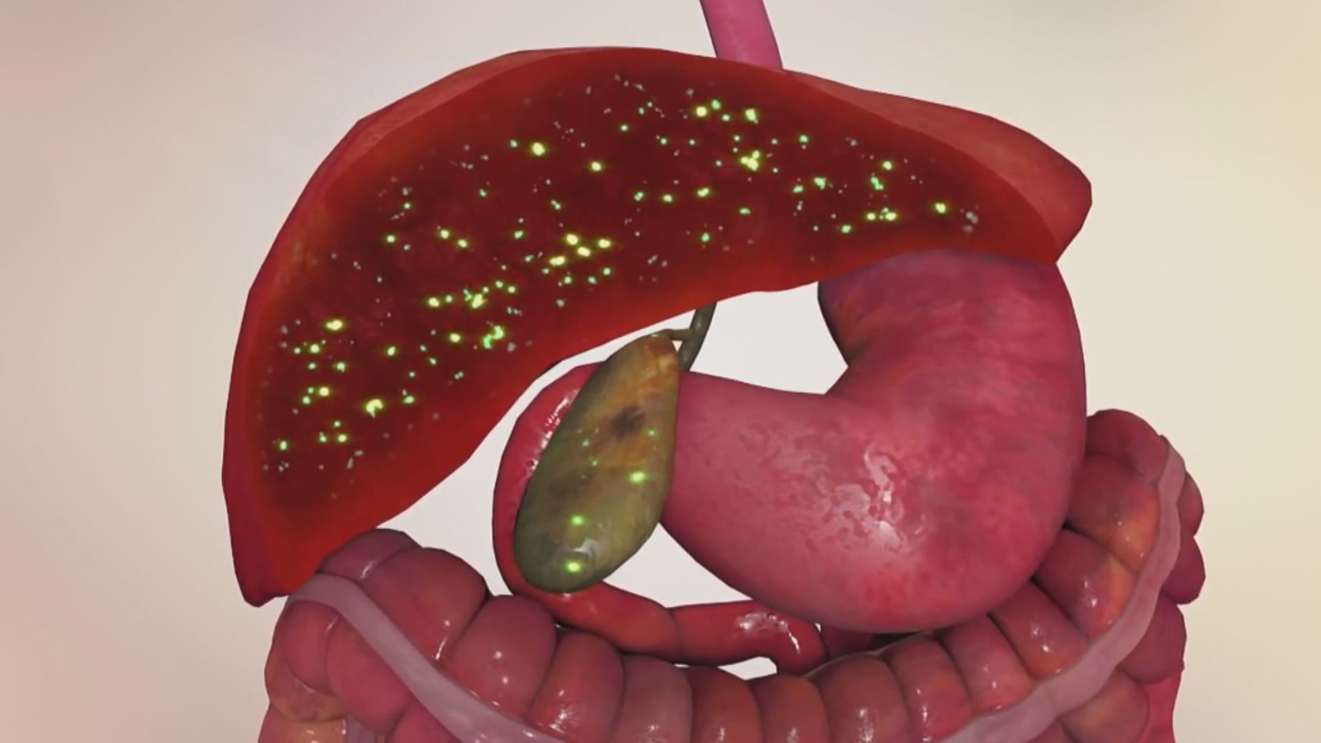 歐美發現多宗兒童患急性肝炎病例　成因未明