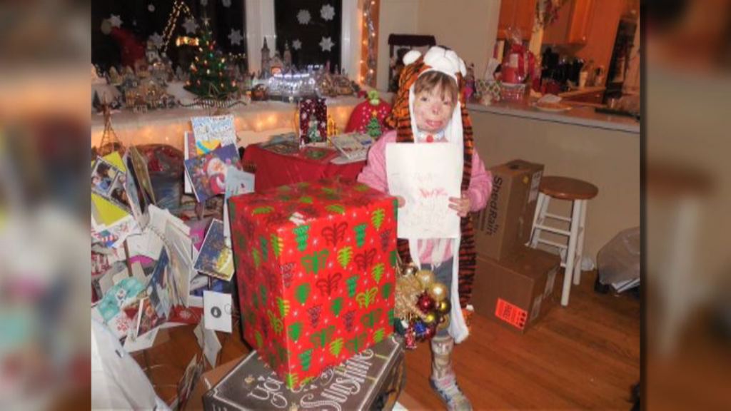 燒傷孤女獲各地民眾聖誕送暖