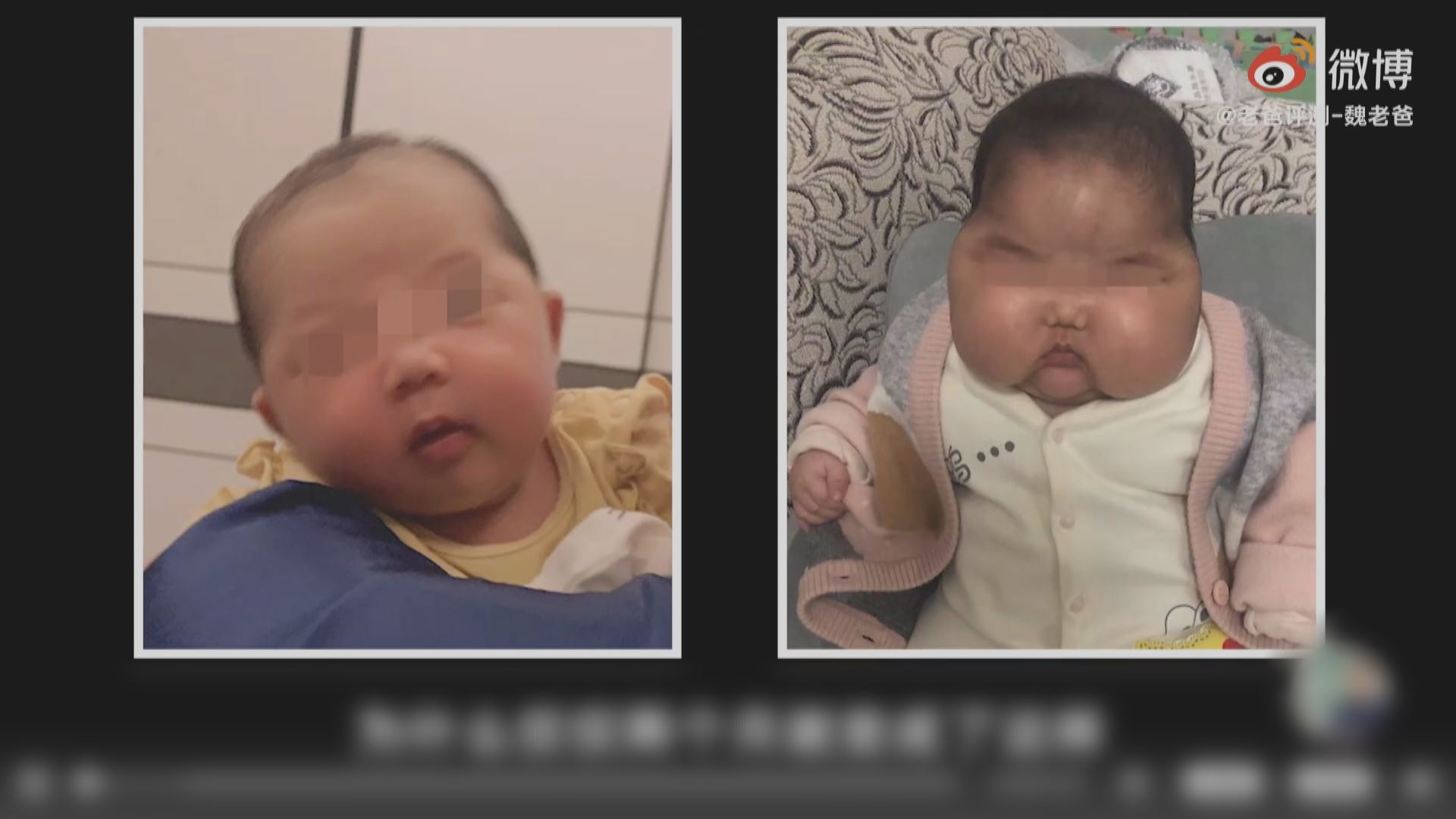 漳州一款抑菌霜懷疑激素超標　當局下令停產回收