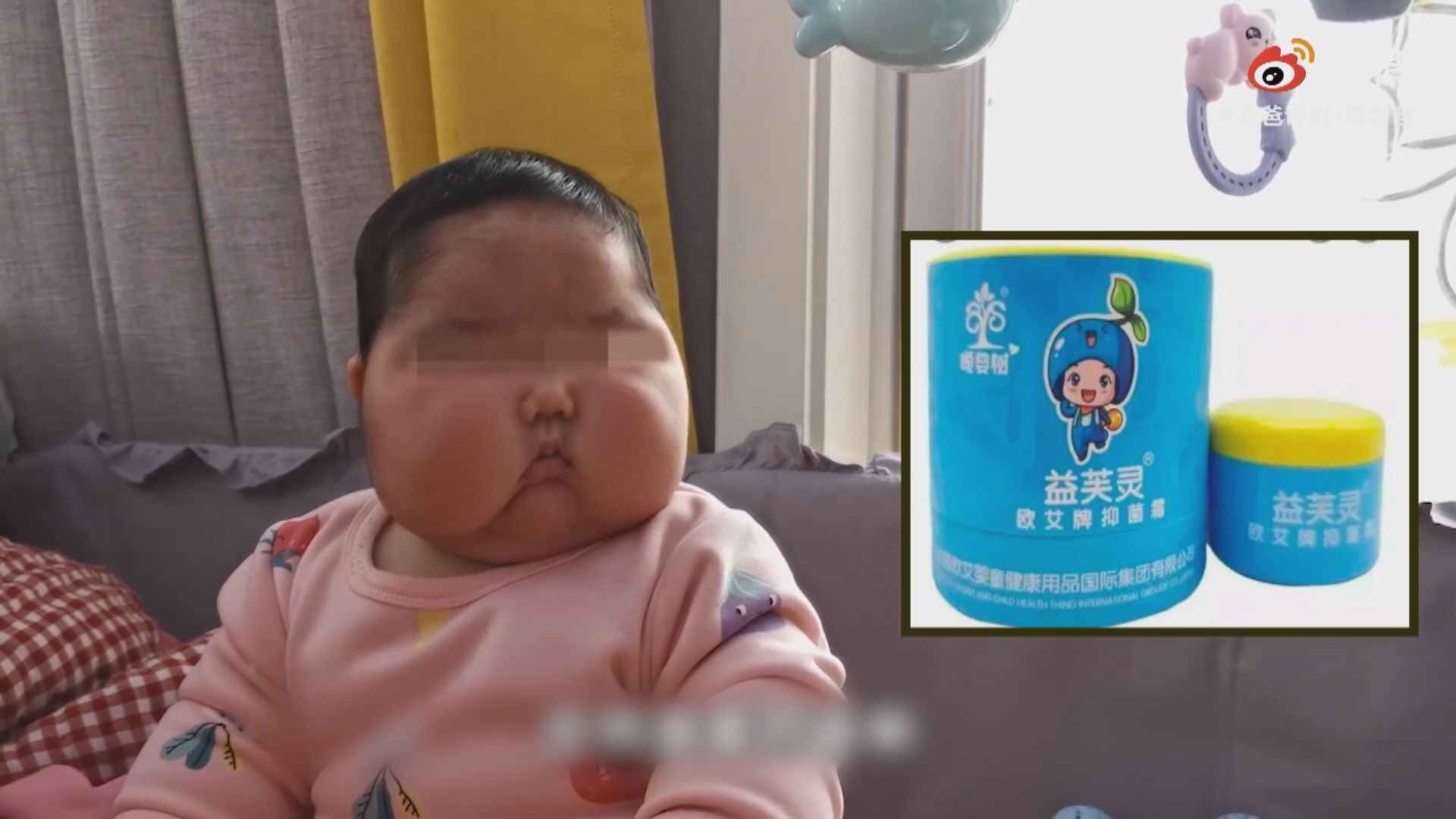 內地有嬰兒使用抑菌霜後出現「大頭娃娃」症狀