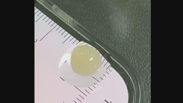 上海科企「器官農場」宣稱培育出目前尺寸最大的「生物人工心臟」