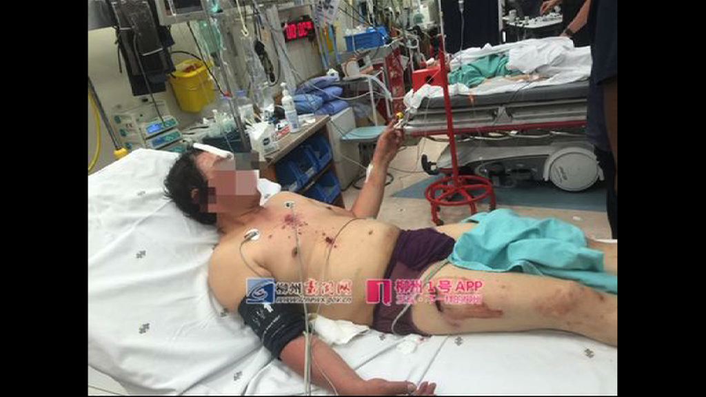 三名廣西柳州人在南非遇劫中槍