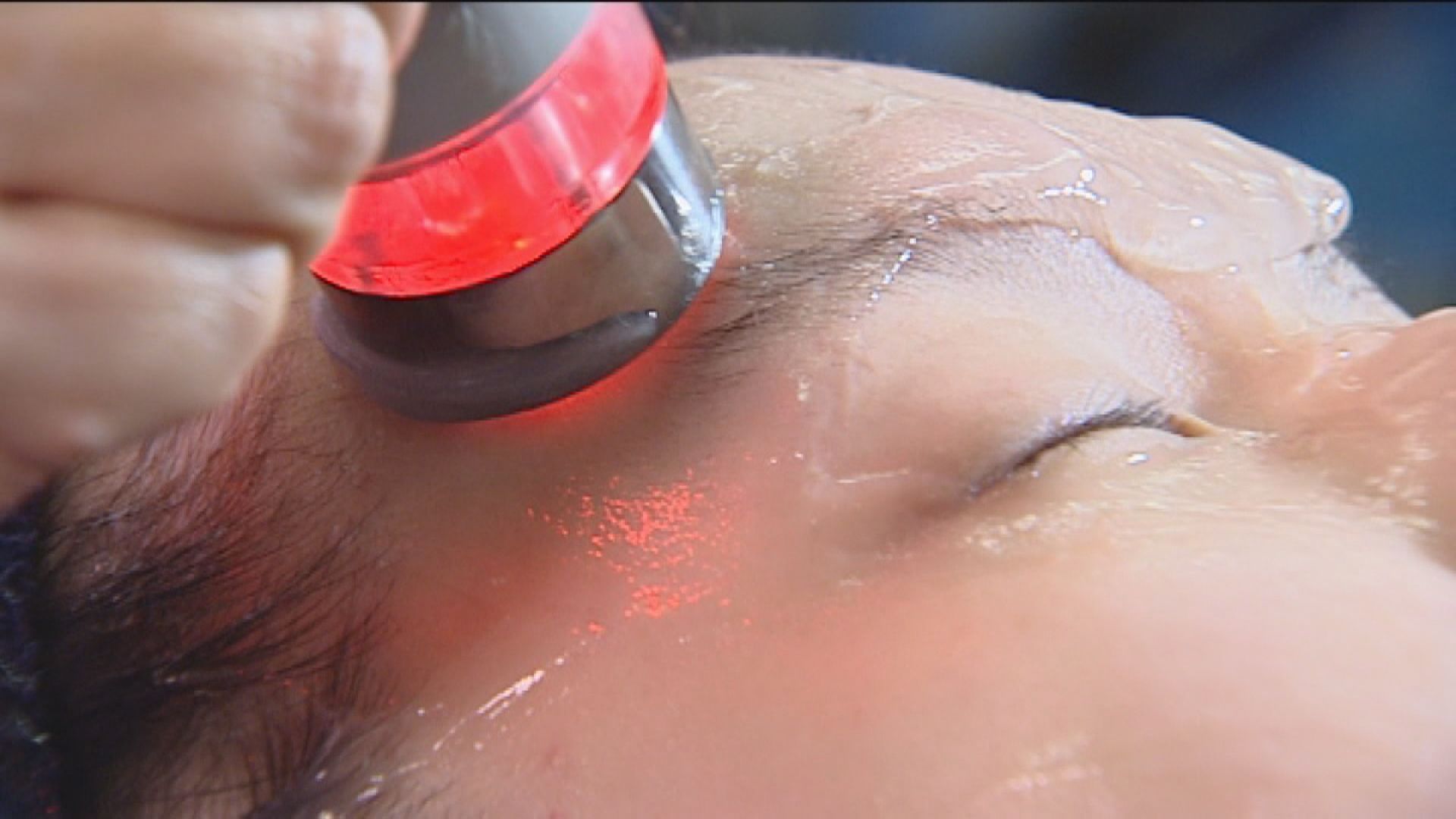 【令人關注】消委會上半年接獲479宗美容服務投訴