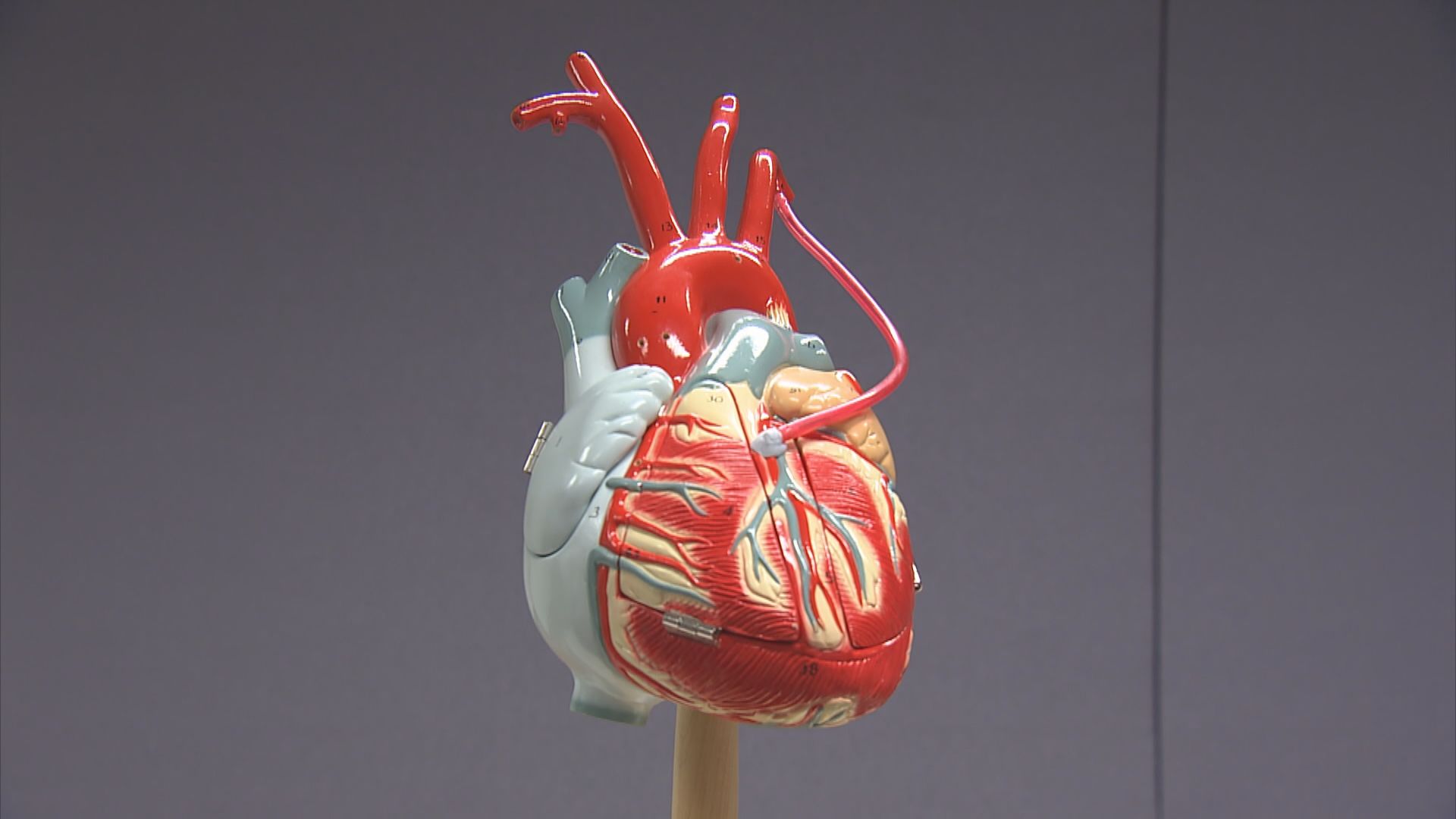 研究發現搭橋手術後控制膽固醇水平　可減心臟併發症風險