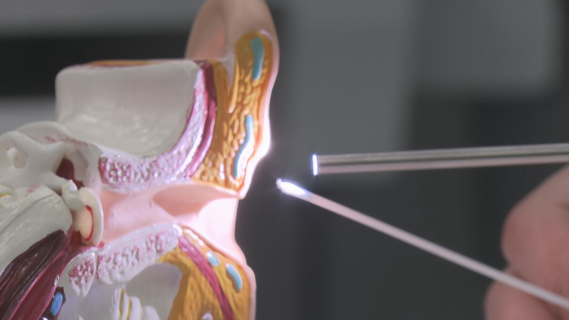 中大研發機械人治療中耳炎患者