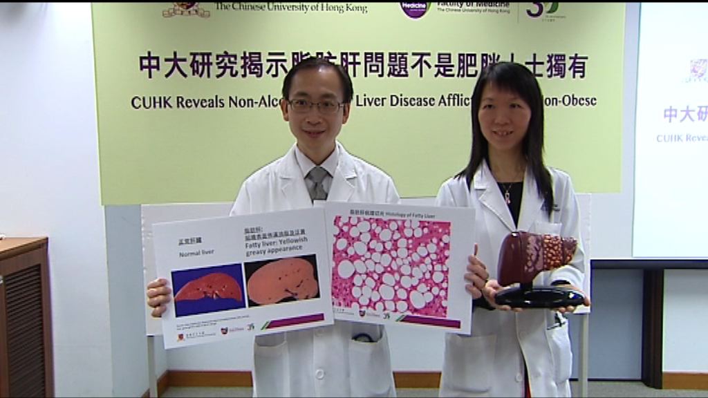 中大研究：糖尿高血壓人士患脂肪肝風險高