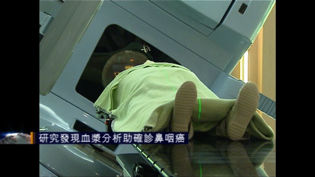 中大研究發現血漿分析助確診鼻咽癌