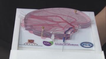 中大研發磁控螺旋微導管　治療中遠端腦血管栓塞