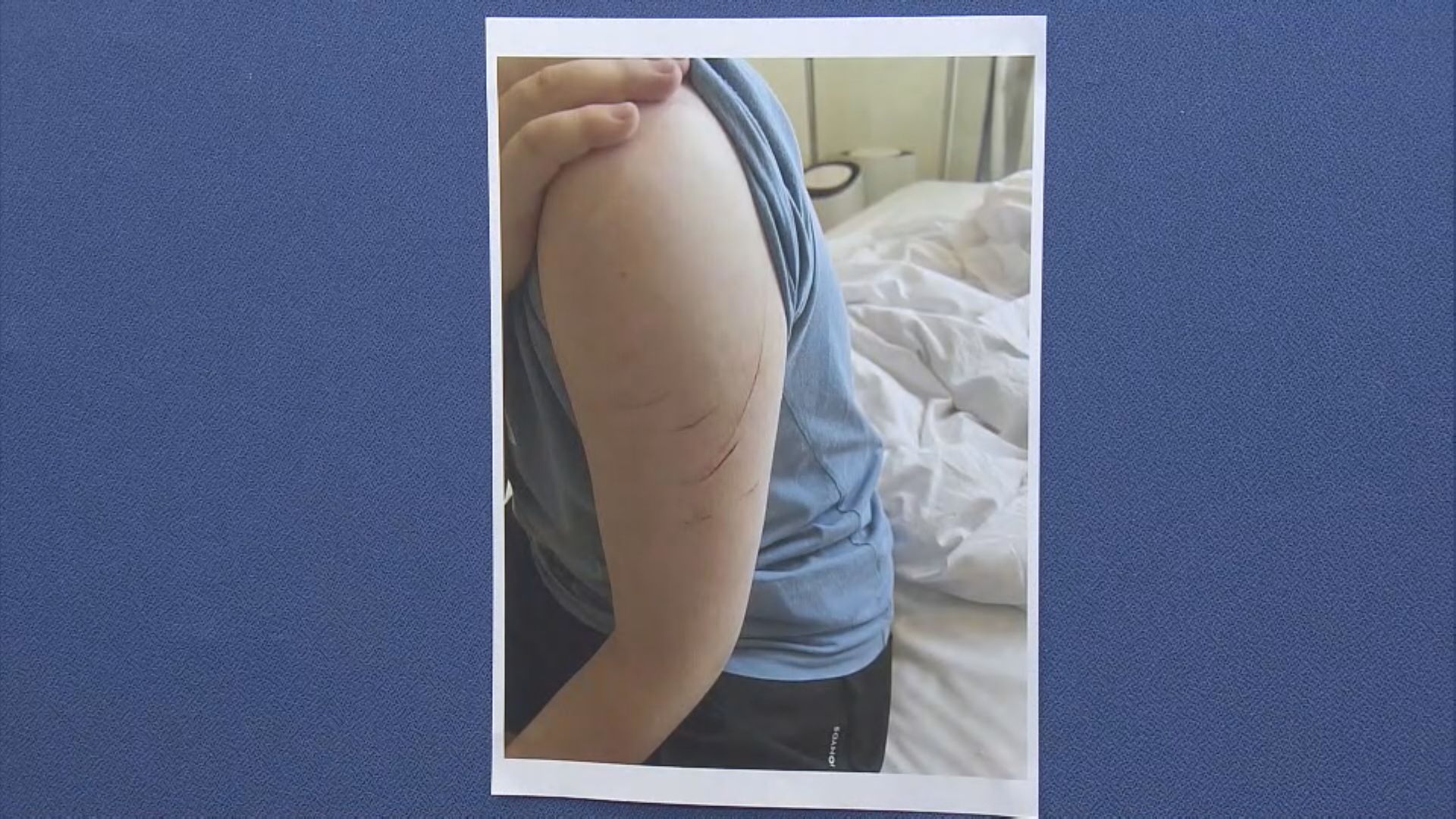 兩留澳內地女生墮電騙失1300萬 誤信騙徒赴港「做特務」自殘獲救