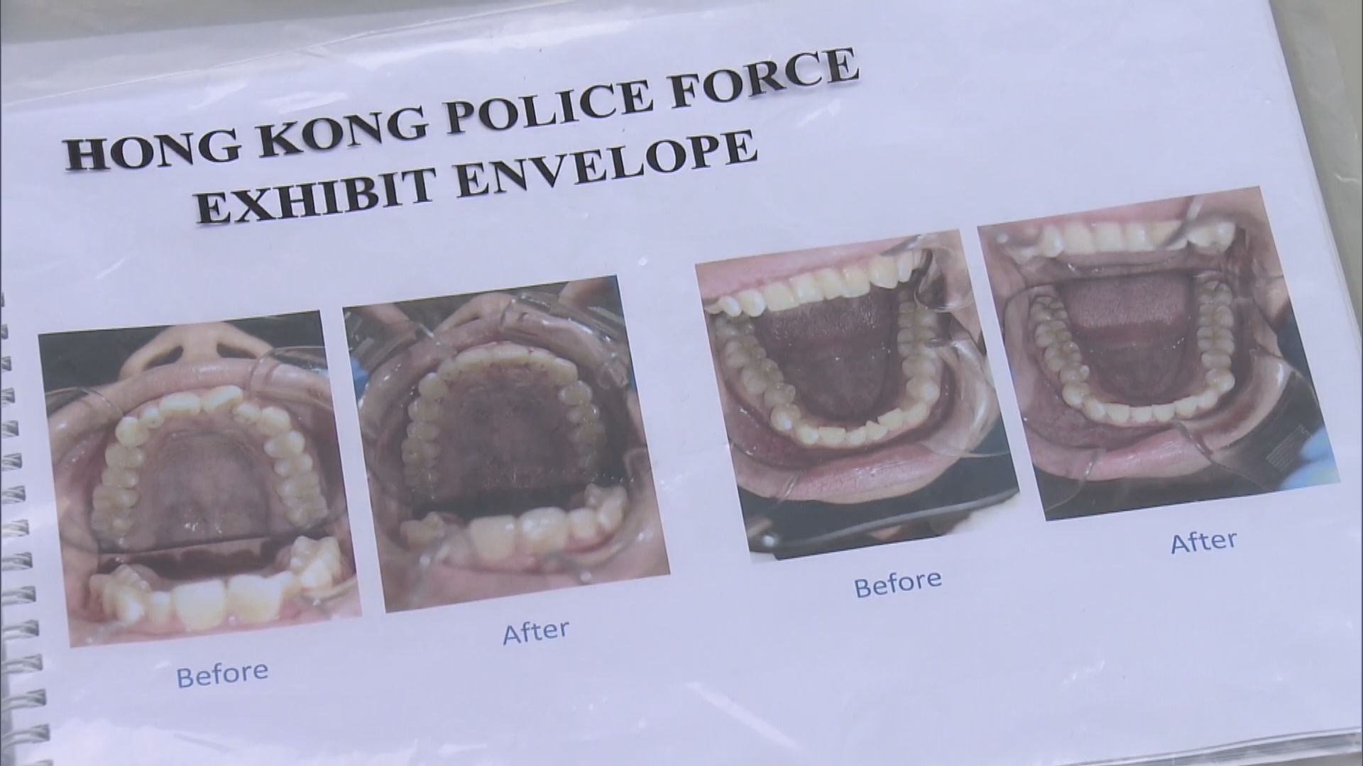 兩女涉未經註冊以牙醫身份執業被捕