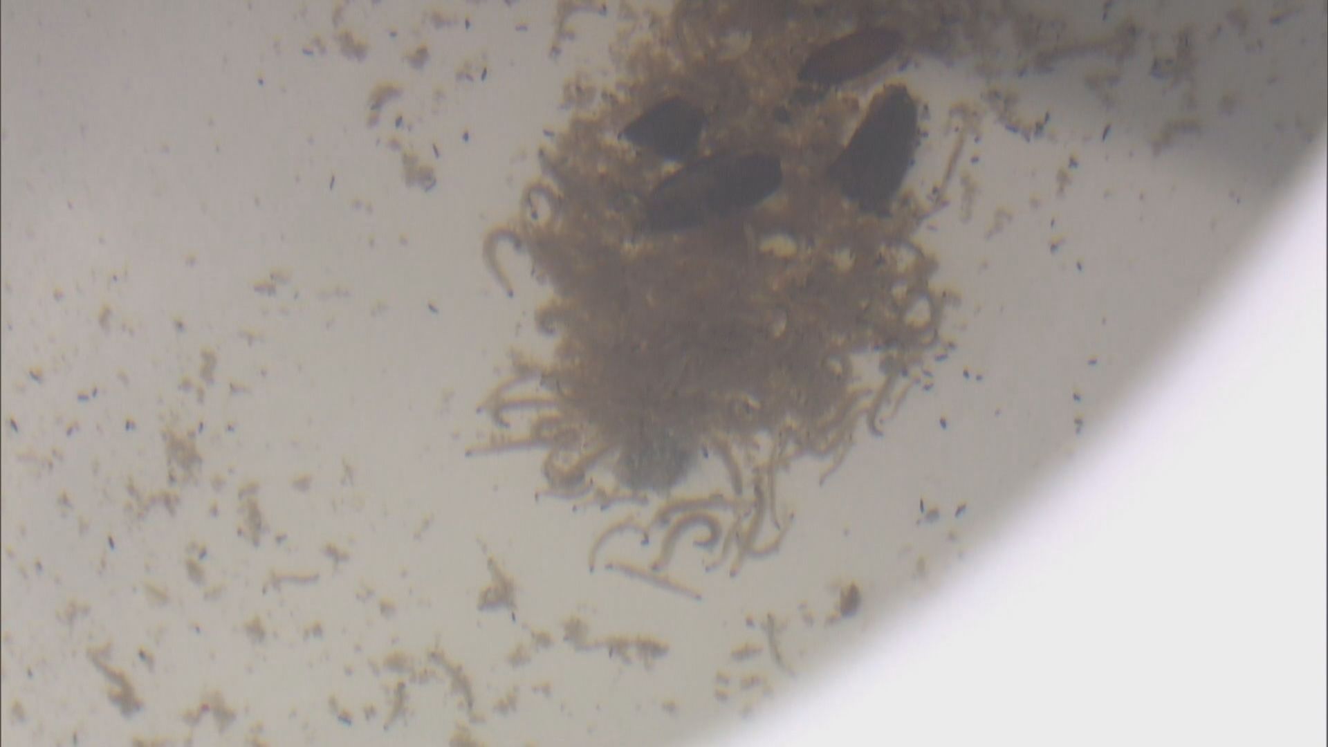 上水寶石湖邨部分單位座廁發現活蟲