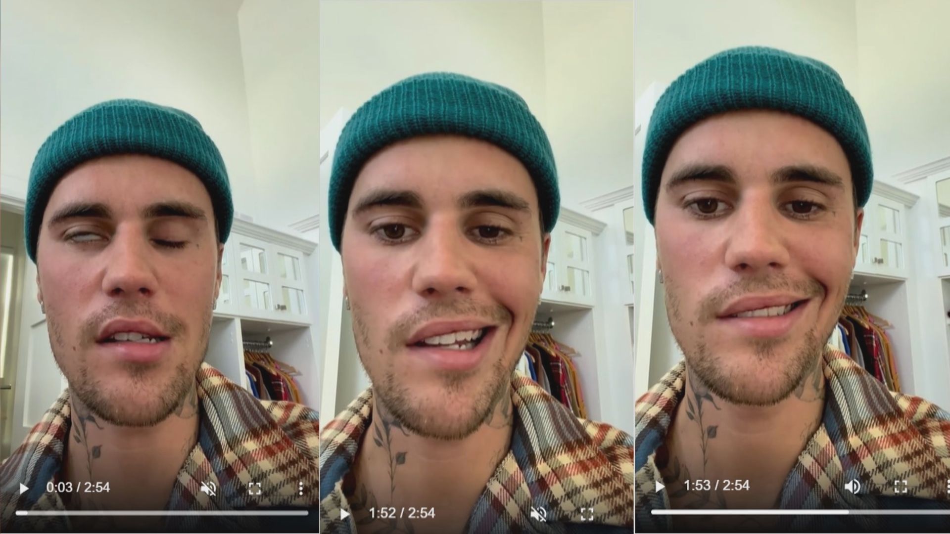 Justin Bieber因面癱取消演唱會