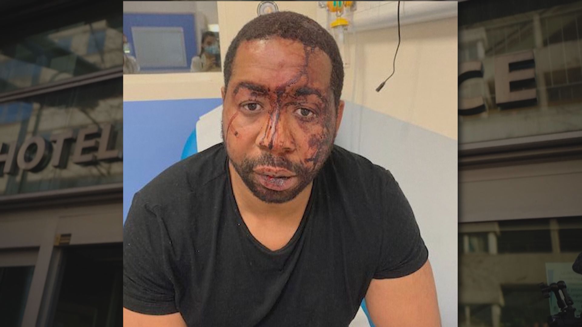 法國接連發生警員懷疑濫用武力事件