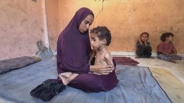 加沙地帶饑荒持續　有夭折幼童死時體重僅四磅多