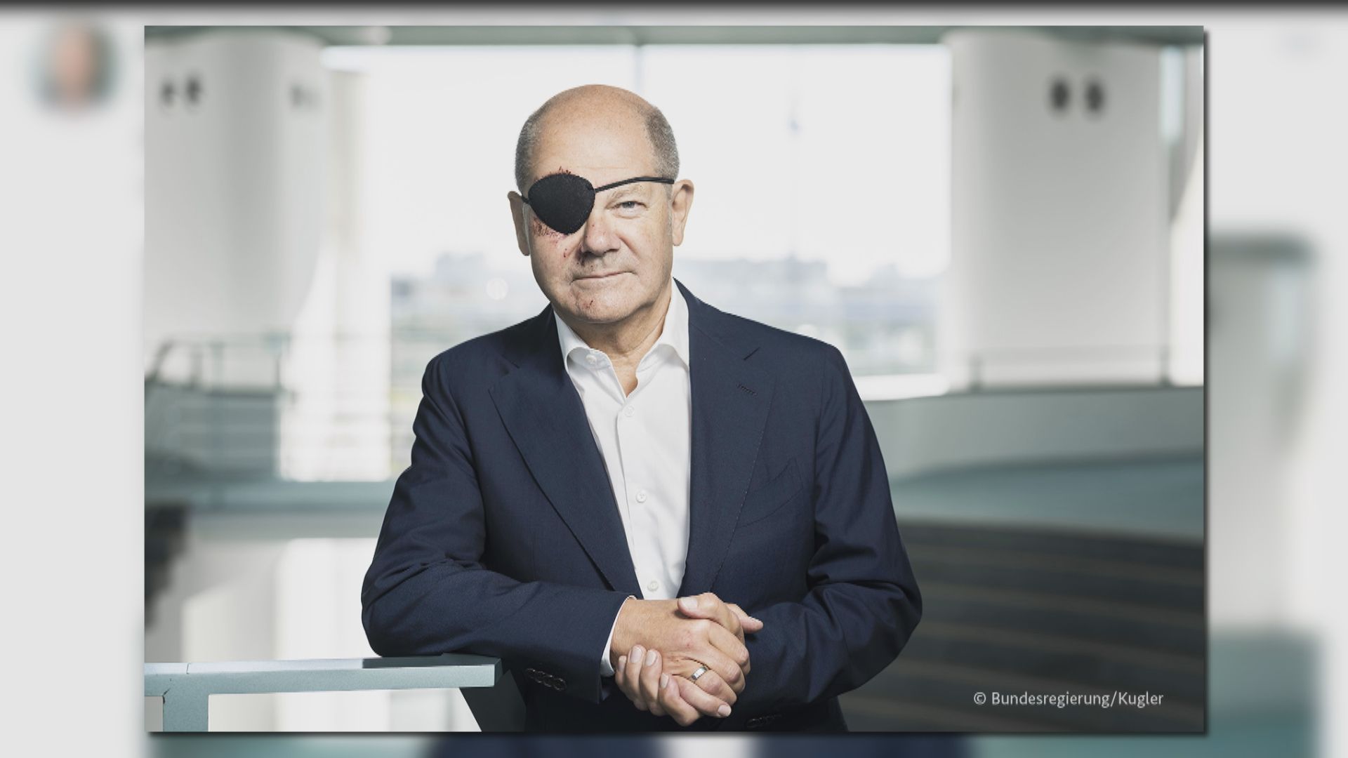 德國總理朔爾茨慢跑摔傷 上載「海盜照」自嘲