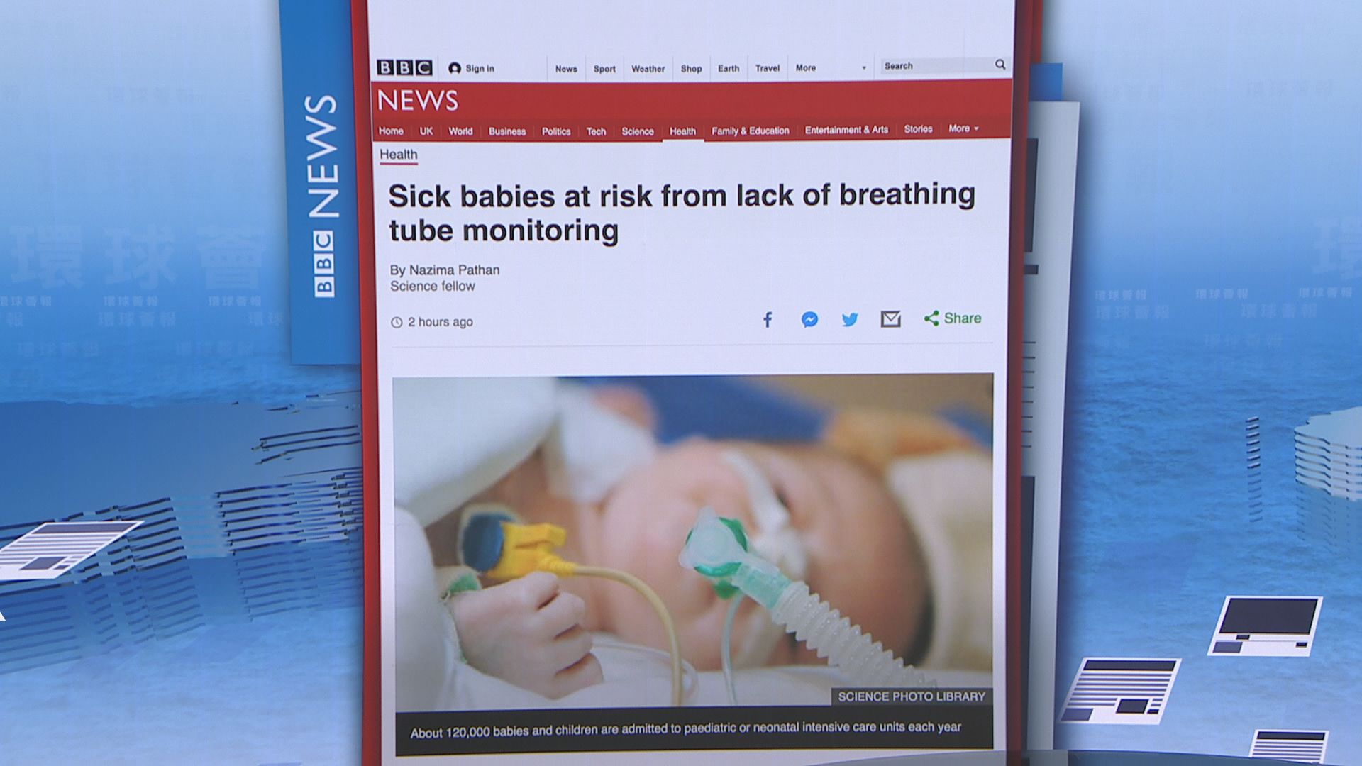 【環球薈報】英部分醫院無準確監測插管嬰兒