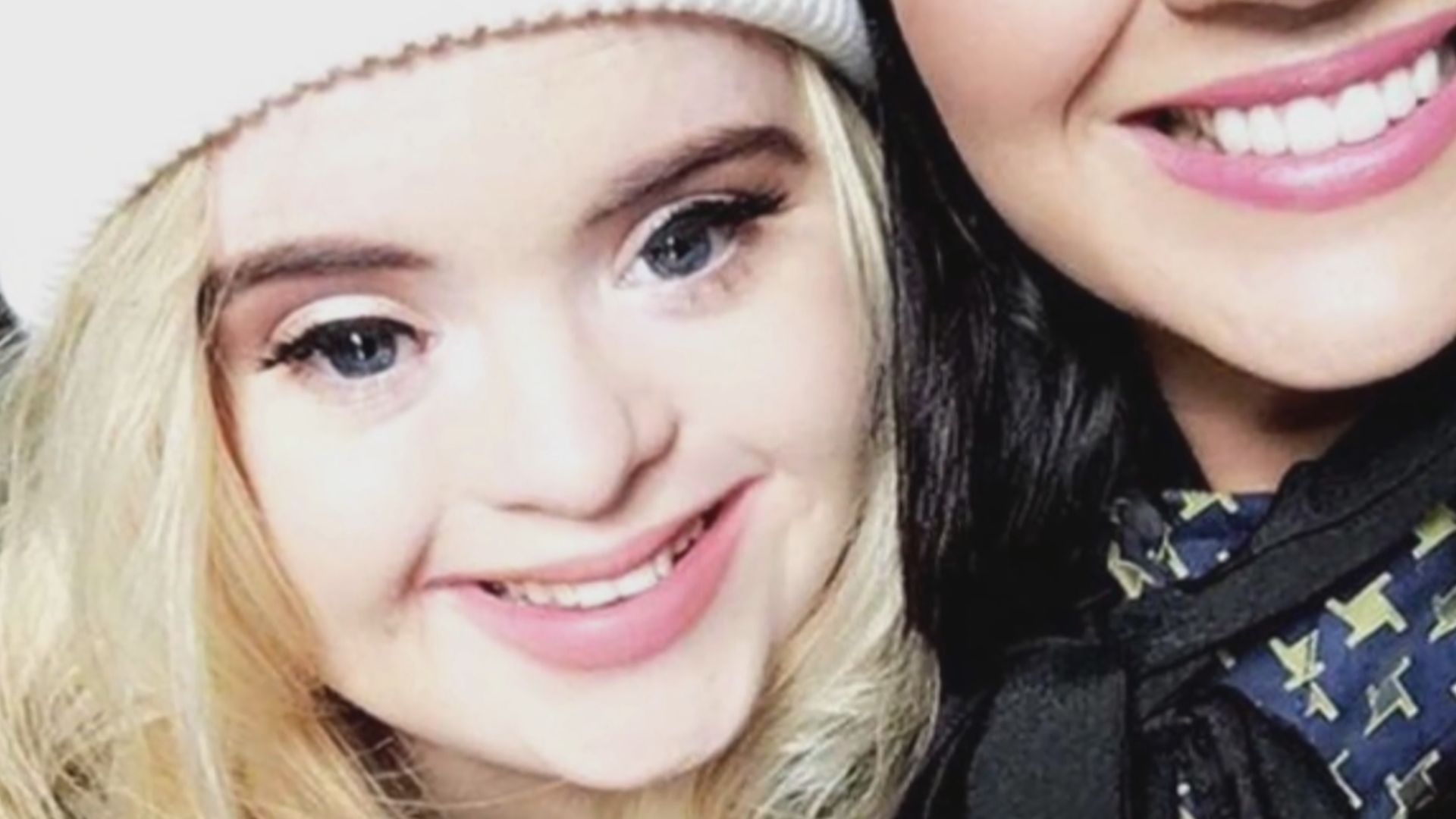 【環球薈報】首次有唐氏綜合症女孩贏得國際選美