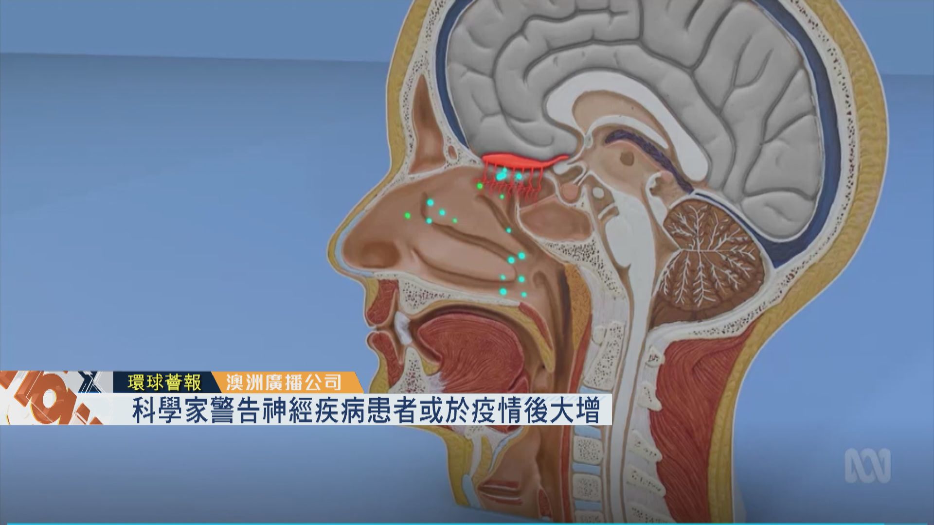 【環球薈報】科學家警告神經疾病患者或於疫情後大增