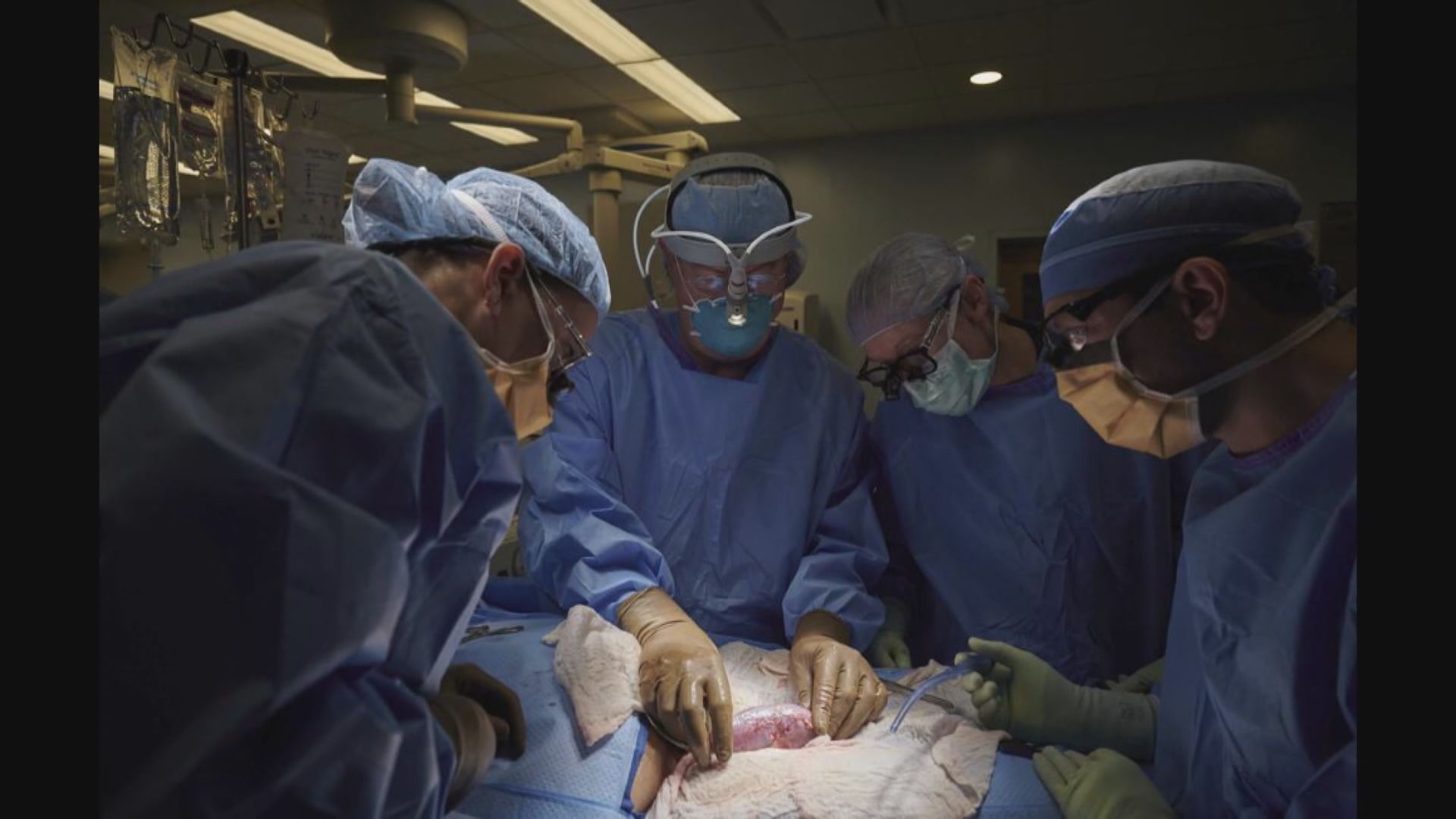 【環球薈報】研究人員成功以基因改造豬腎臟移植人體