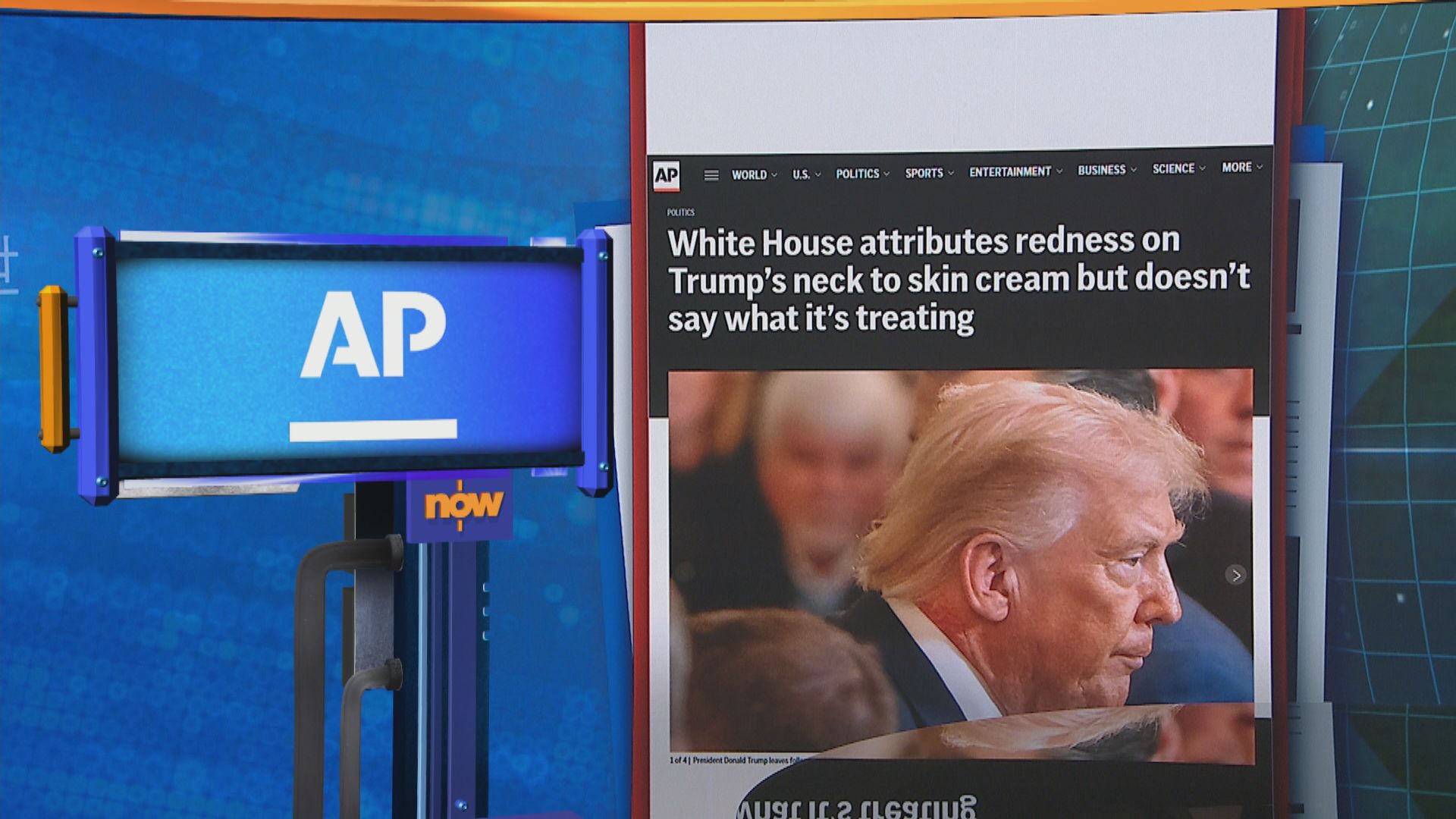 世味天下｜特朗普右頸出現大片紅疹　健康狀況惹外界關注