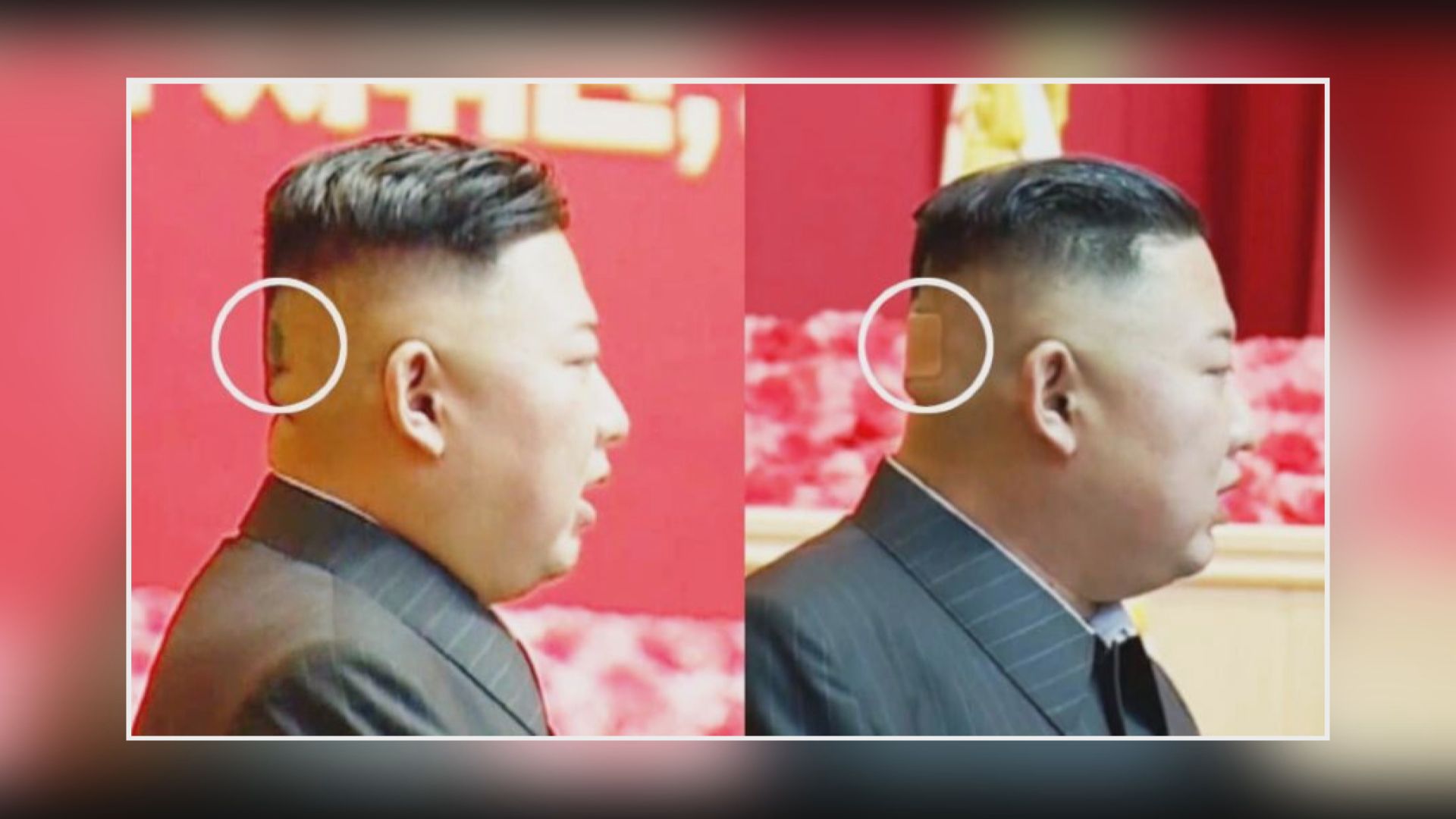 【環球薈報】專家指金正恩健康情況全球僅十五人知道