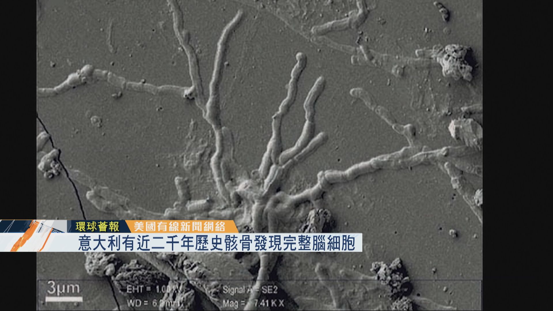 【環球薈報】意大利有近二千年歷史骸骨發現完整腦細胞