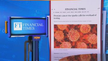 【世味天下】《刺針》研究預測全球前列腺癌個案20年間將翻倍