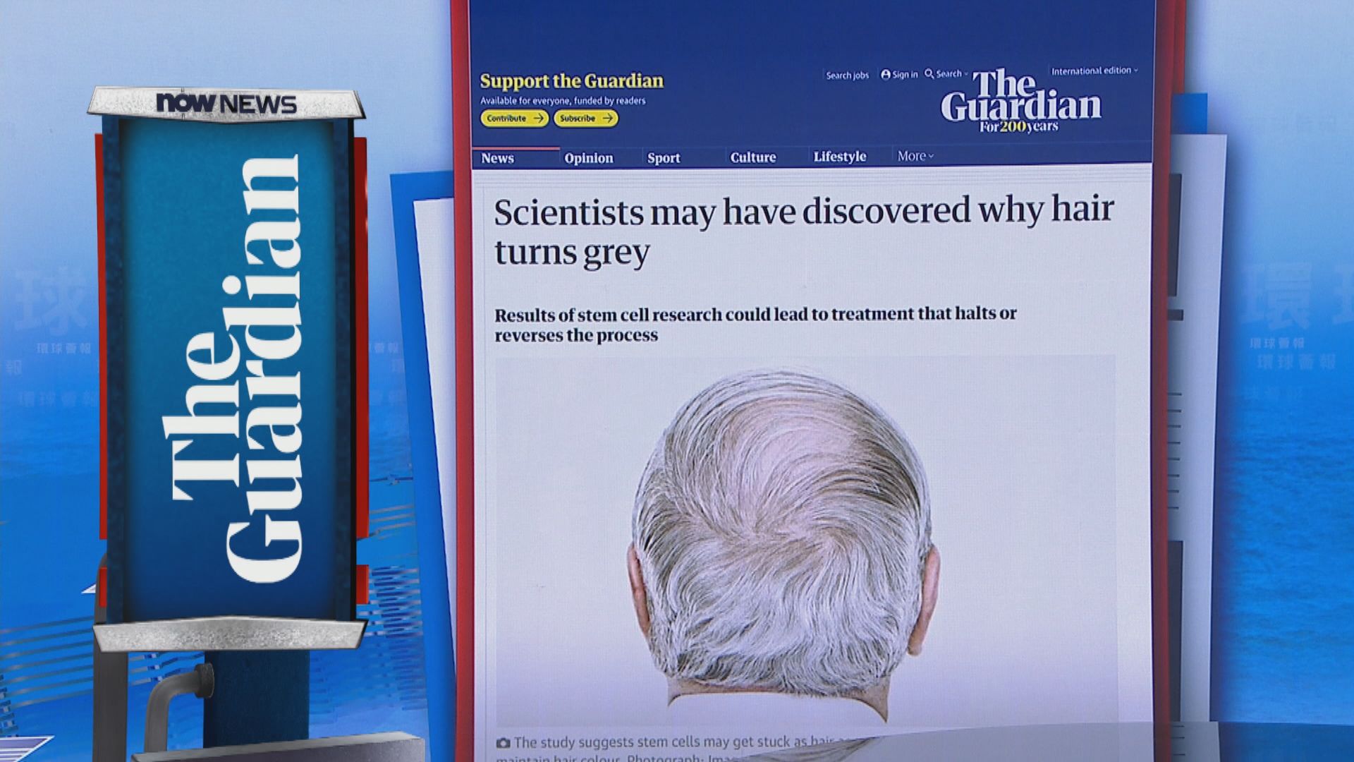 【環球薈報】美科學家指解決幹細胞「塞車」問題頭髮或可由白變黑