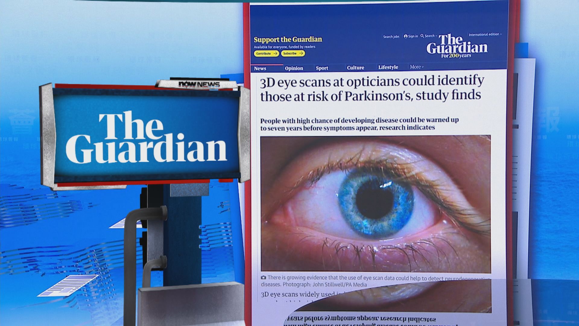 【環球薈報】眼球掃描或能助提早七年預防柏金遜症