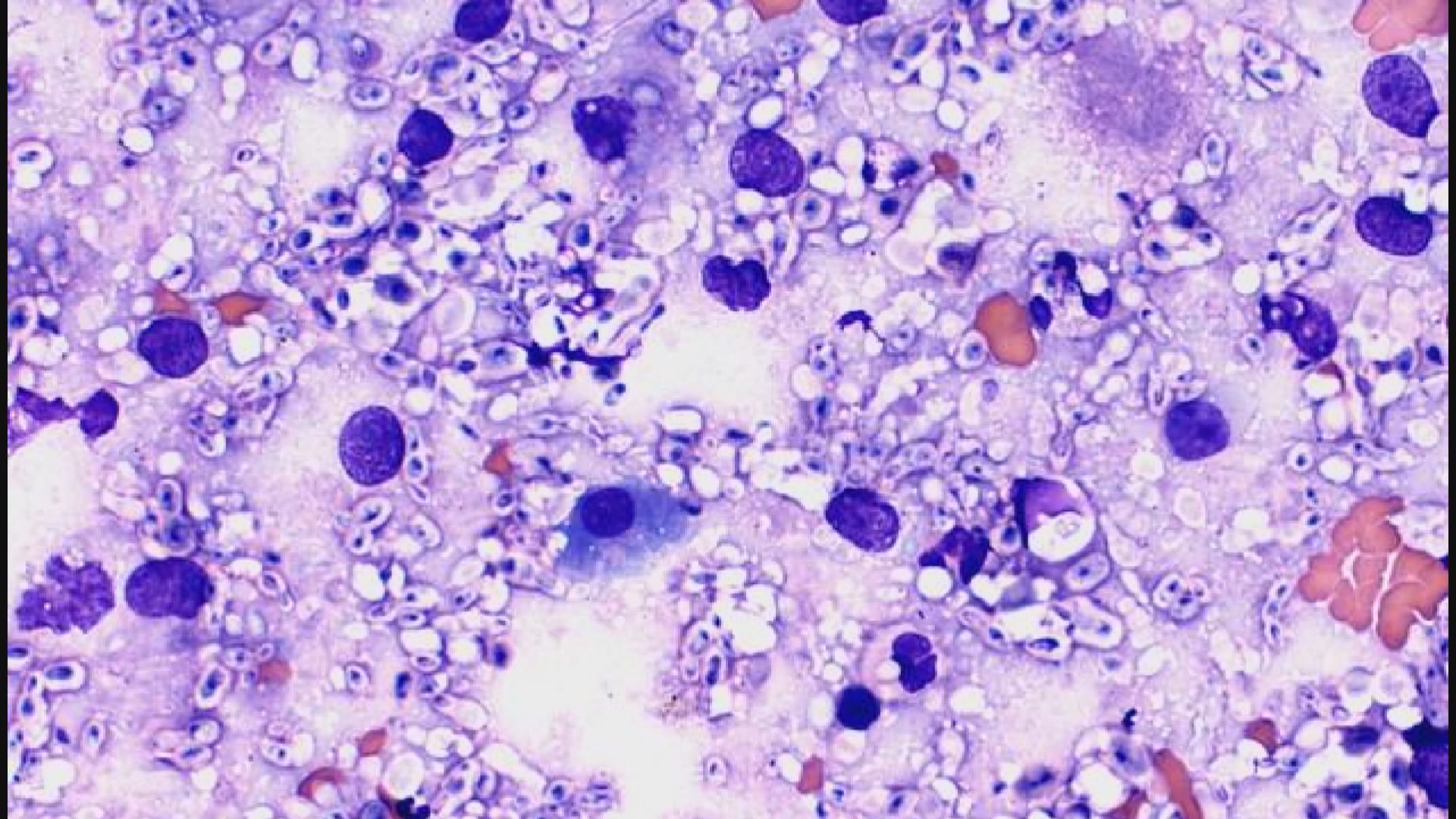 【環球薈報】科學家發現一種真菌能吸收輻射