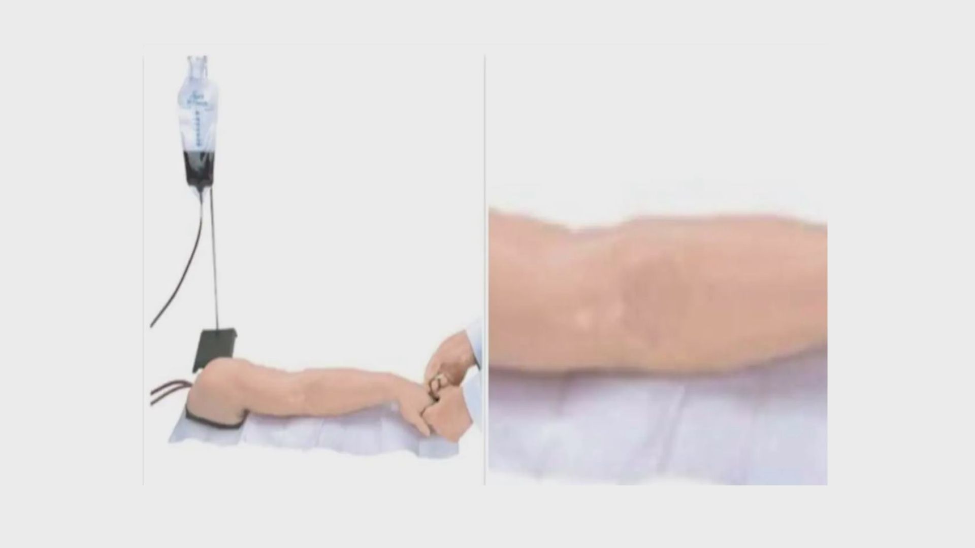 【環球薈報】網售九千元假手臂聲稱能騙取疫苗接種證明