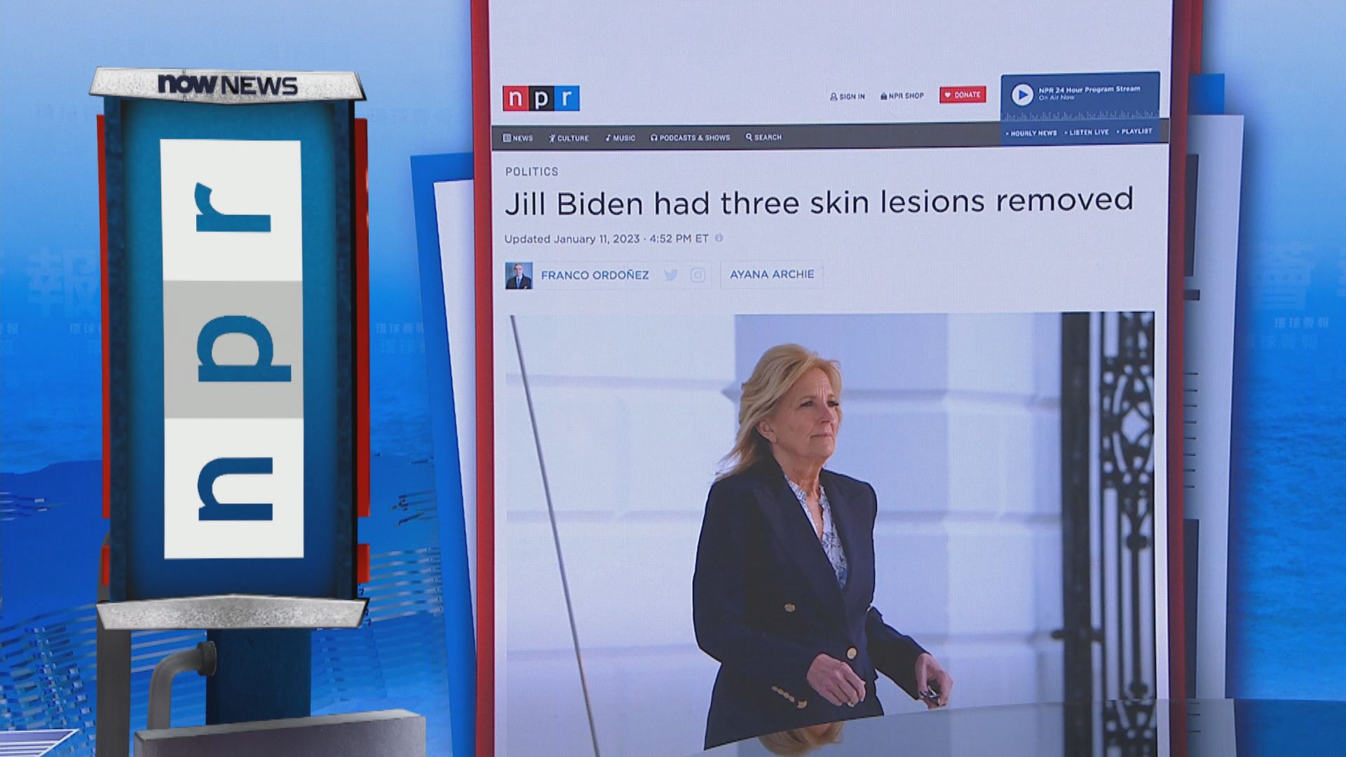 【環球薈報】美國第一夫人吉爾切除三處出現癌前病變皮膚組織