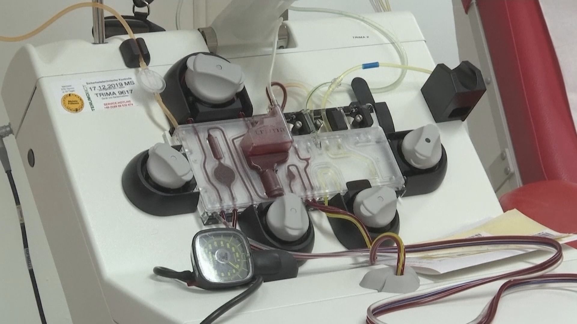 【環球薈報】美國女子透過臍帶血幹細胞移植治癒愛滋病