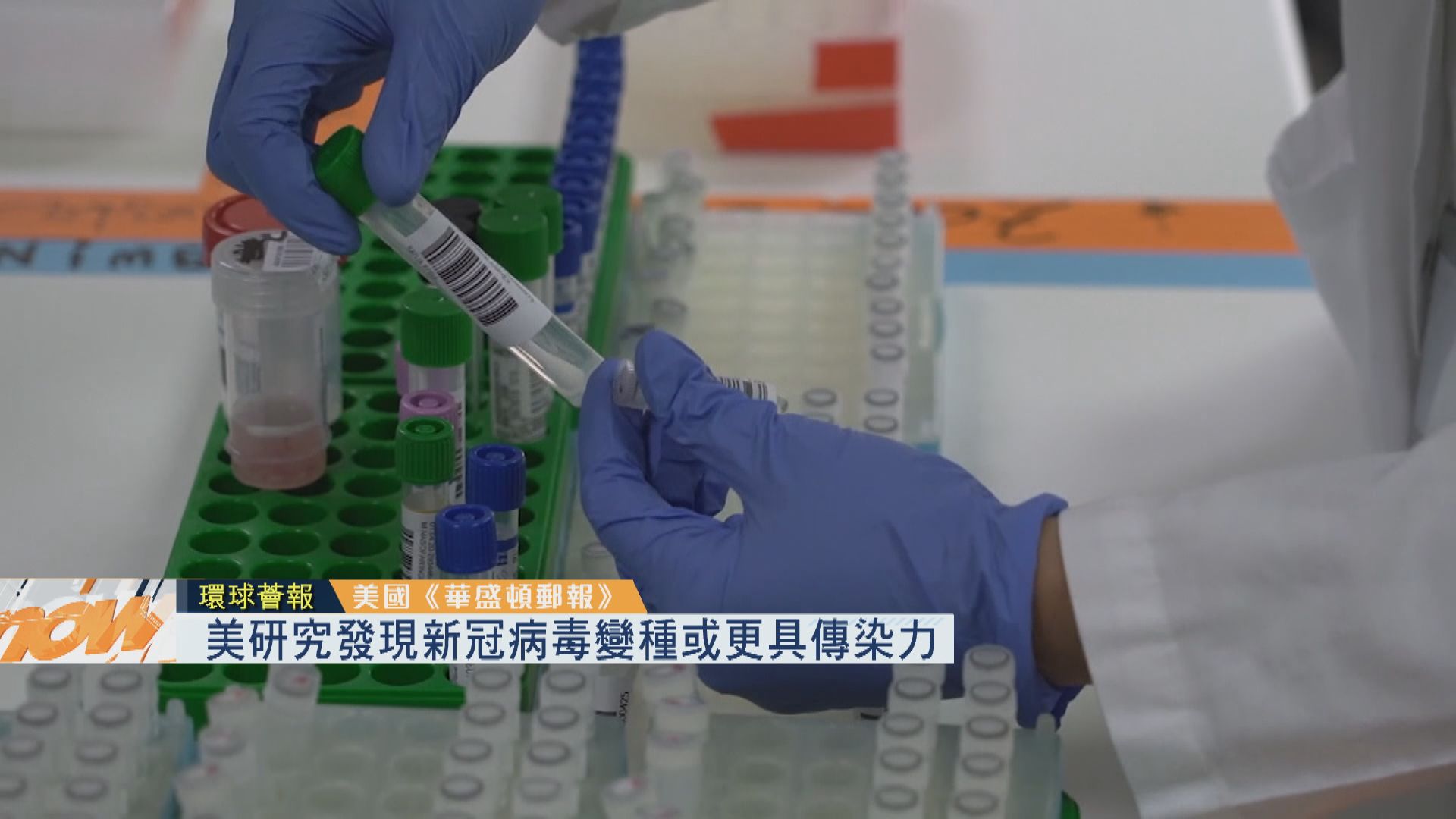 【環球薈報】美研究發現新冠病毒變種或更具傳染力