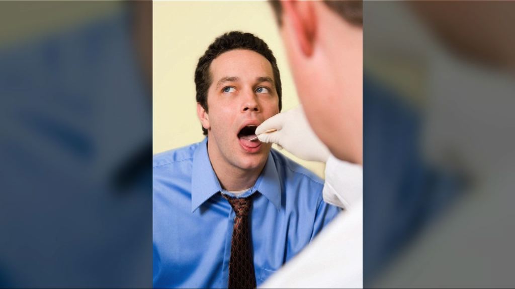 【環球薈報】美學者研10分鐘用唾液檢測癌