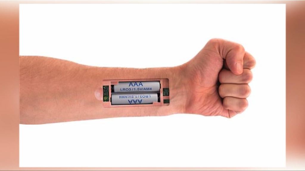 【環球薈報】新型彈性電池以含鹽溶液推動人工起搏器