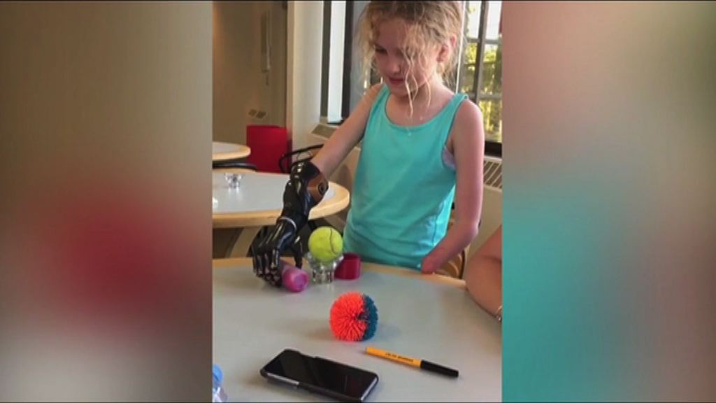 【環球薈報】3D打印仿生手助小孩靈活操控