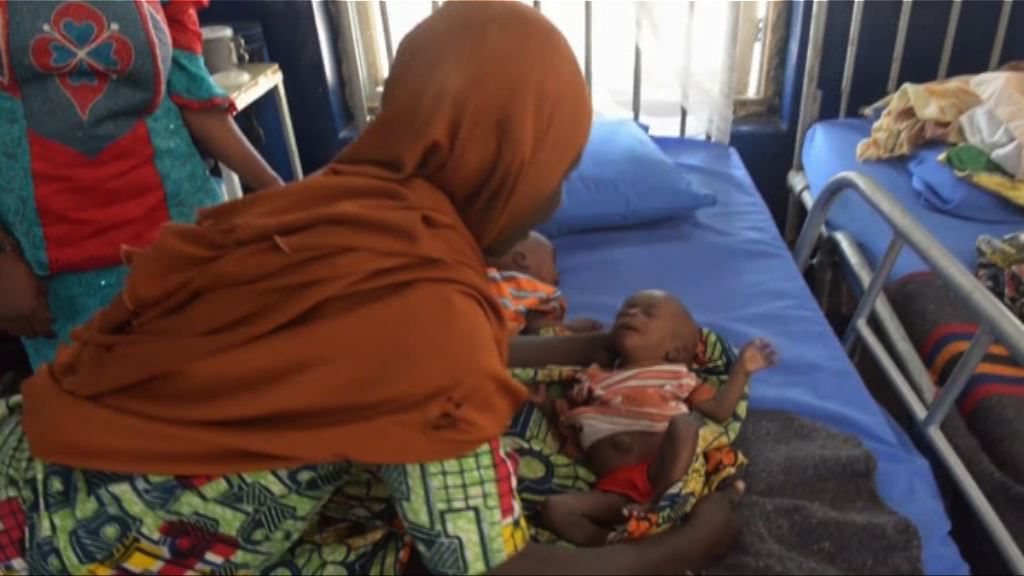 【環球薈報】聯合國指巴基斯坦嬰兒夭折率全球最高