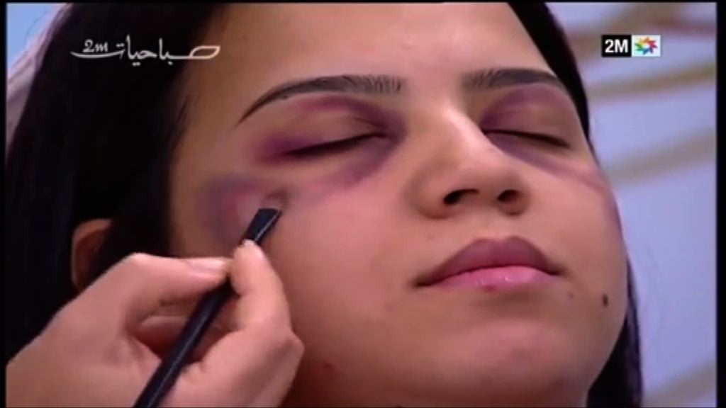 【環球薈報】摩洛哥節目教遮家暴瘀傷惹抨擊