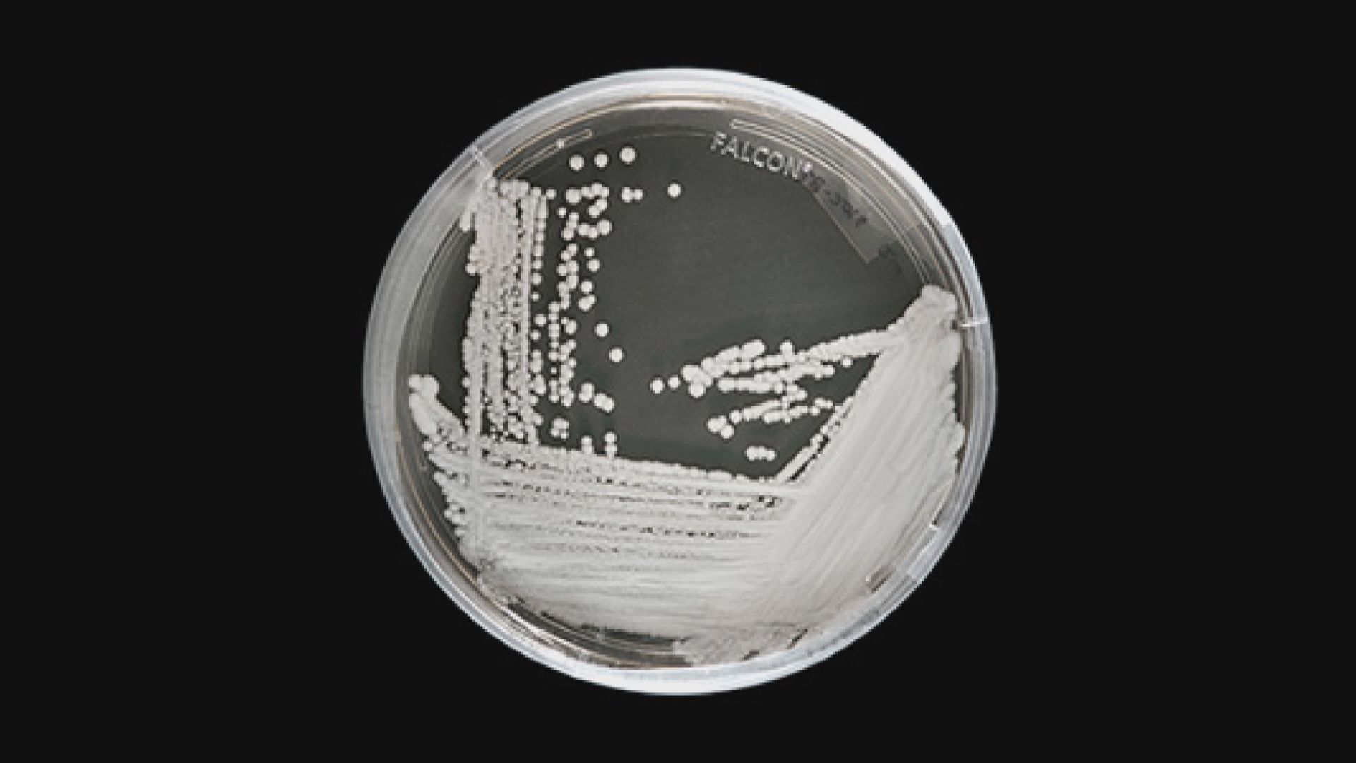 兩醫院七月耳念珠菌爆發　約130人帶菌