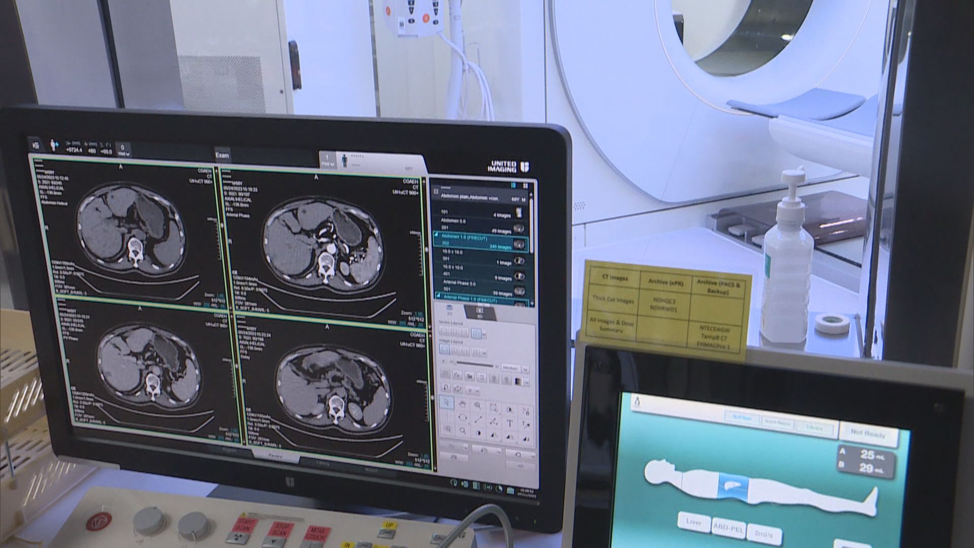 河套區應急醫院推放射診斷服務 本月擴至全港公院病人