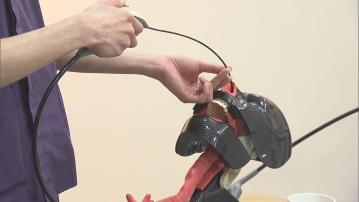 內窺鏡吞嚥訓練助復康　中風病人兩個月內順利拔除鼻胃喉